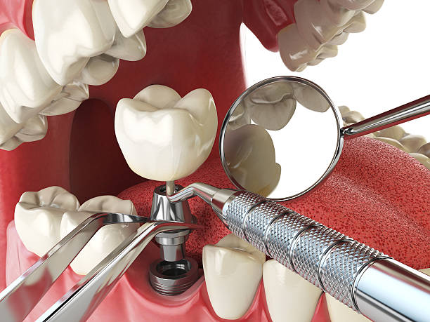 Best Orthodontic Emergency Dentist in Holden, MO
